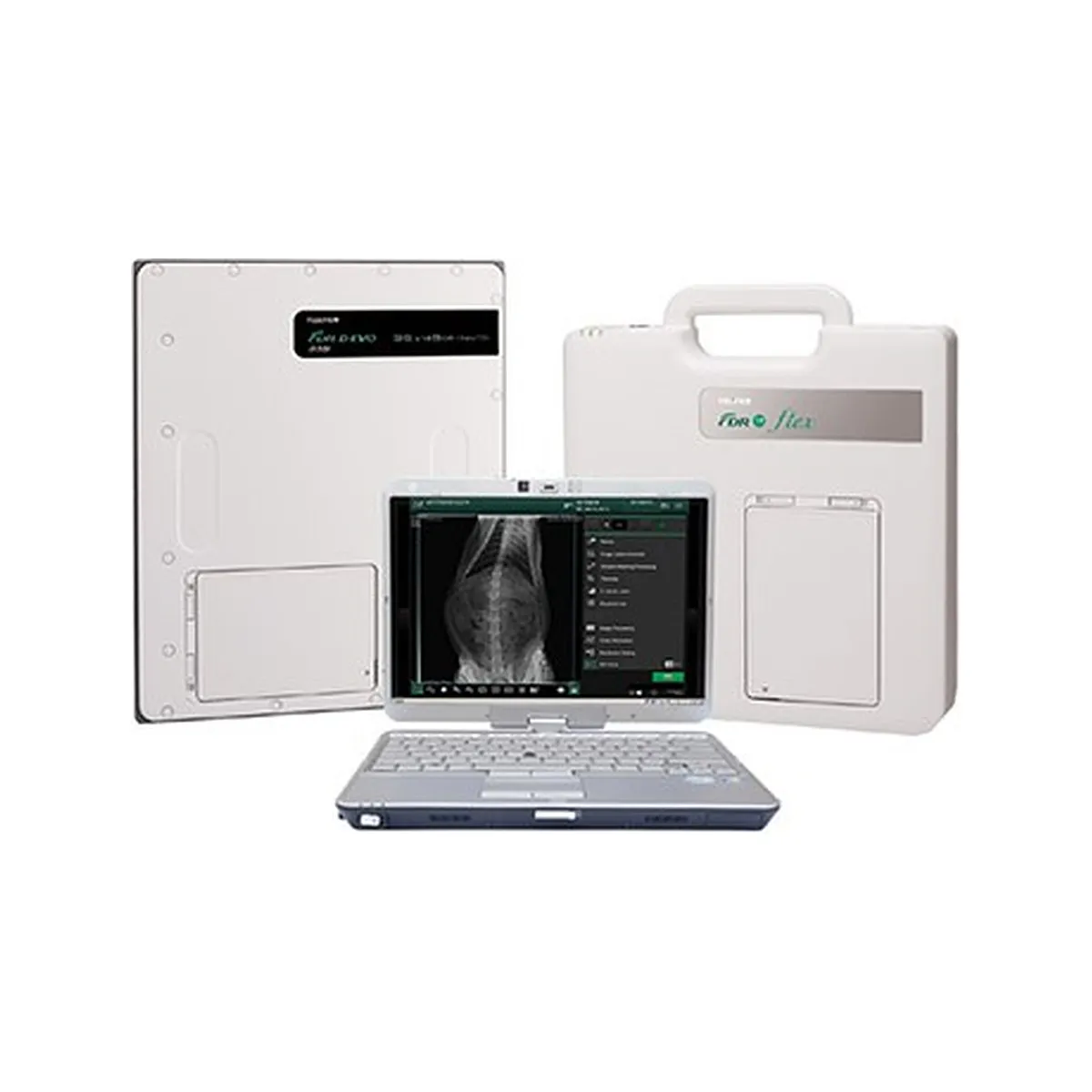 FDR-flex with FDR D-EVO II